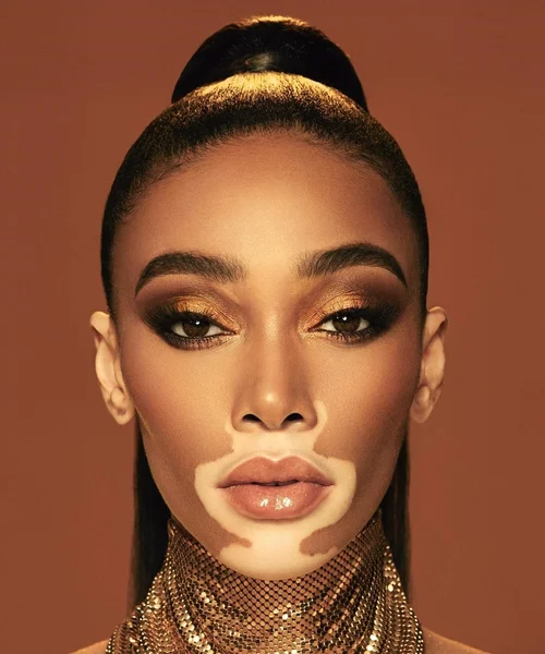 Winnie Harlow — Dark Autumn